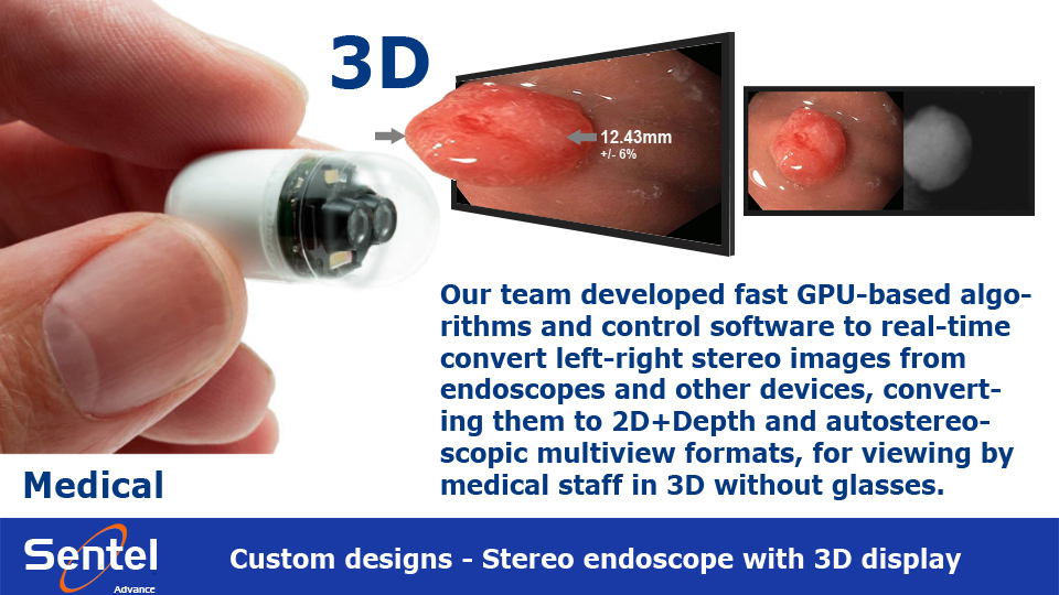 Sentel Medical 3D endoscope